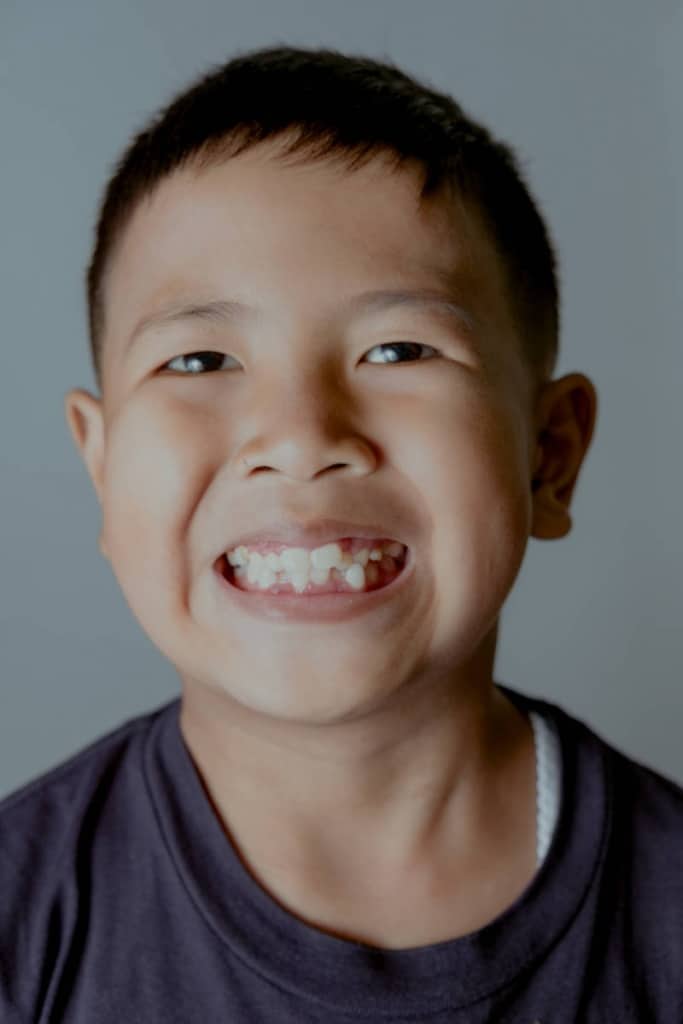 Ortodoncia infantil con Adeslas
