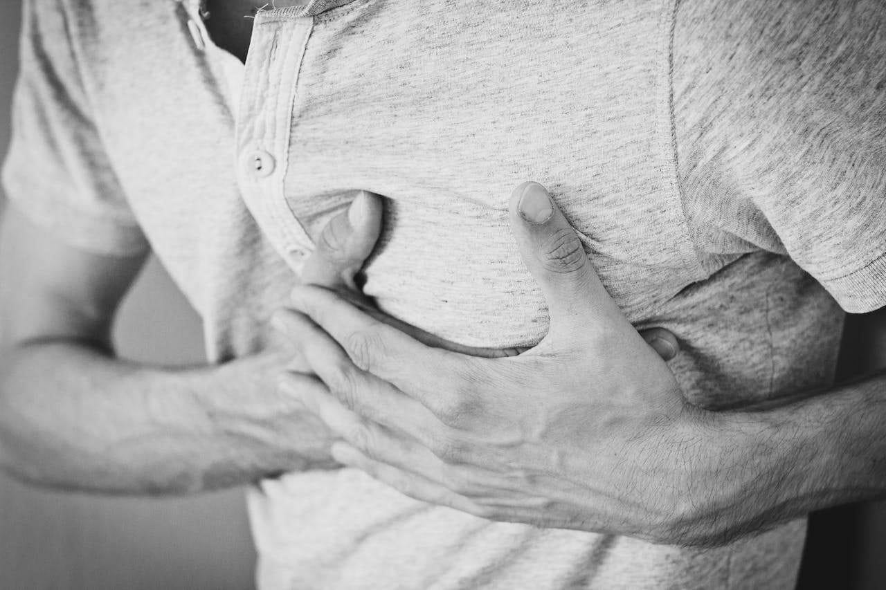 Infarto miocardio
