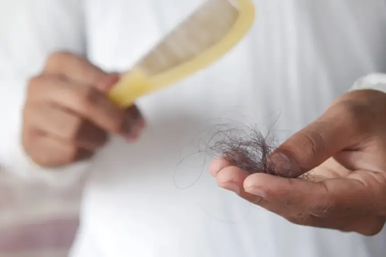 Cobertura de Adeslas para la alopecia y el trasplante capilar